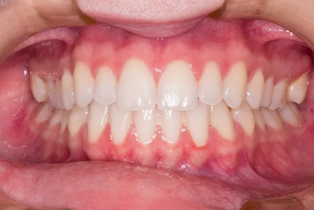 teeth, smile, dentist, teeth, teeth, dentist, dentist, dentist, dentist, dentist. Dental SEO agency profiles and interview questions