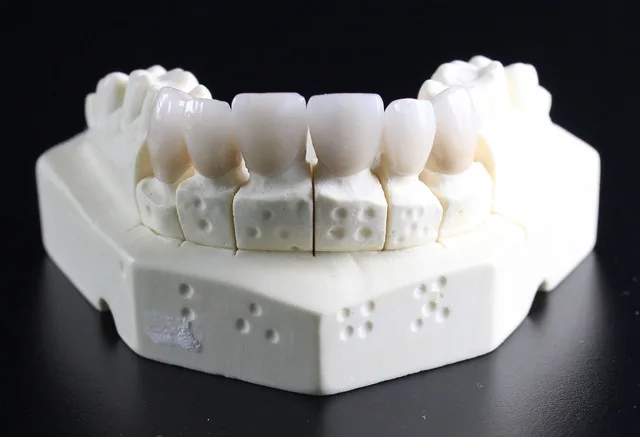 dentures, teeth, dental technician, teeth, teeth, teeth, teeth, teeth. Bilingual dental SEO in Montreal and Ottawa compared for patient search