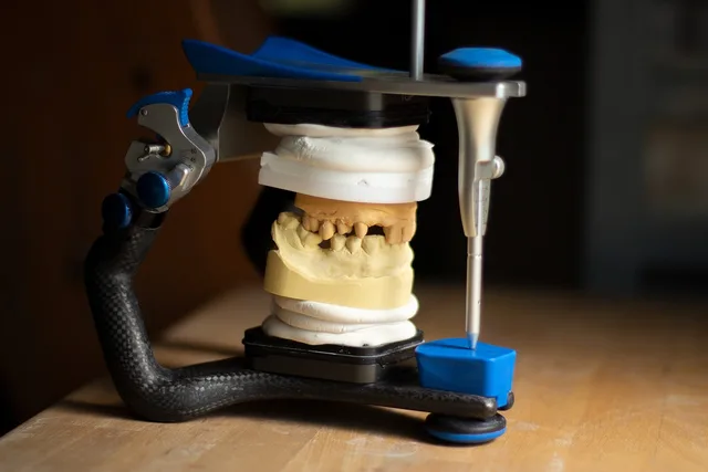 dentures, dentist, healthcare, dentistry, smile, ceramic, instruct, handwork, person, clinic, equipment, healthy, articulator, dentures, dentures, dentures, dentistry, articulator, articulator, articulator, articulator, articulator. Dental reputation management: what the FTC review rule allows