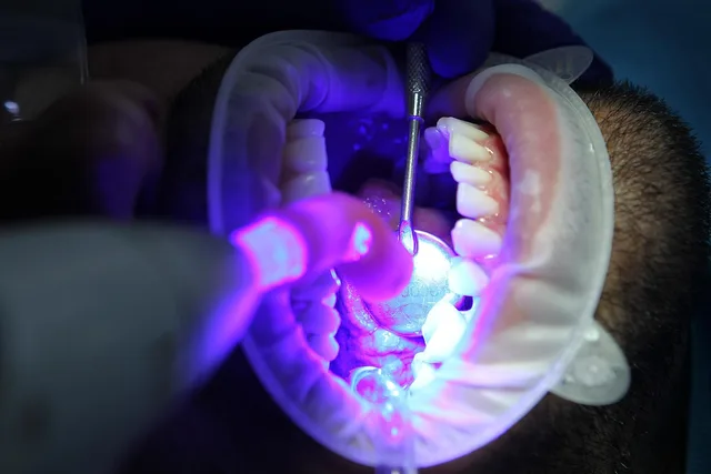 dentist, oral health, dental health, oral hygiene, dental hygiene, teeth cleaning, teeth whitening, teeth whitening, teeth whitening, teeth whitening, teeth whitening, teeth whitening. One failed whitening claim, one working test: two dental ad stories
