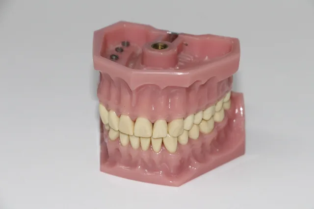 dental prosthesis, artificial teeth, dentition, dentist, dental instruments, dental equipment, dental office, dental doctor, repair teeth, meshing, tooth grinding instruments, tooth drill attachment, teeth cleaning, tooth repairs, treat teeth, brush teeth, check teeth, dental prosthesis, artificial teeth, artificial teeth, dentist, dentist, dentist, dentist, dentist, teeth cleaning, teeth cleaning, teeth cleaning. Dental advertising examples for planning campaigns
