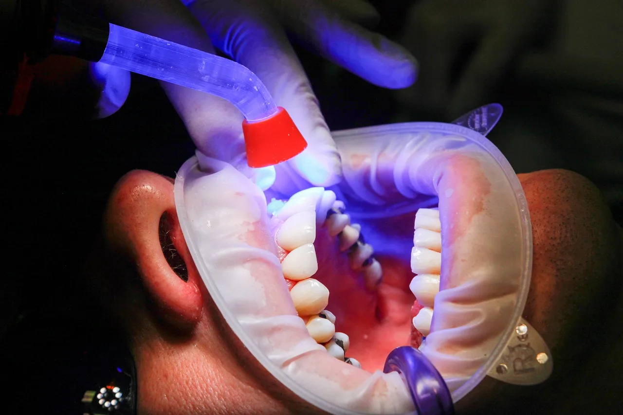 dentist, facet, uv light, curing, teeth, mouth, treatment, uv lamp, patient, clinic, dentist, dentist, dentist, dentist, dentist, teeth. Dental content marketing: audience, claims, review, and maintenance