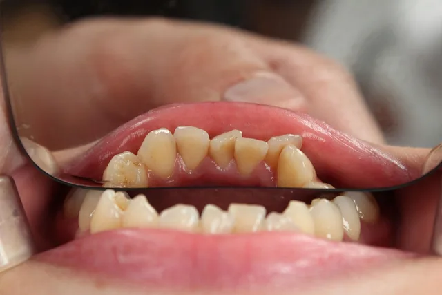 tooth, dentist, mouth, odontology, doctor, tooth, tooth, tooth, tooth, tooth, dentist, dentist, dentist, dentist. Dental marketing strategy tools judged on daily use