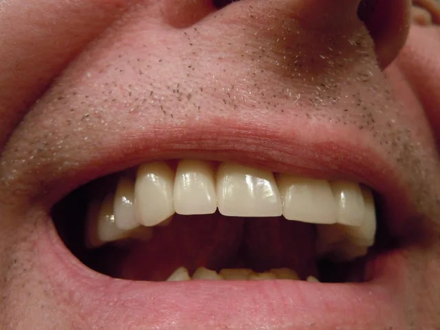 teeth, dental, tooth, mouth, lips, crowns, caps, ceramic, teeth, teeth, teeth, dental, dental, tooth, tooth, tooth, tooth, tooth, mouth. Dental patient acquisition best practices: intake handoff
