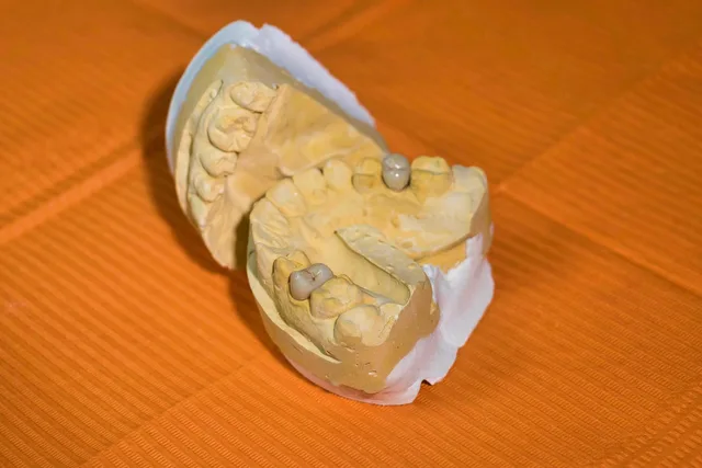 mold, dental, dentist, teeth, molar, reconstruction, plant, form, mouth, ceramics, nature, ache, caries, tartar, hygiene. Patient acquisition mistakes for dental practices often start with manipulative design
