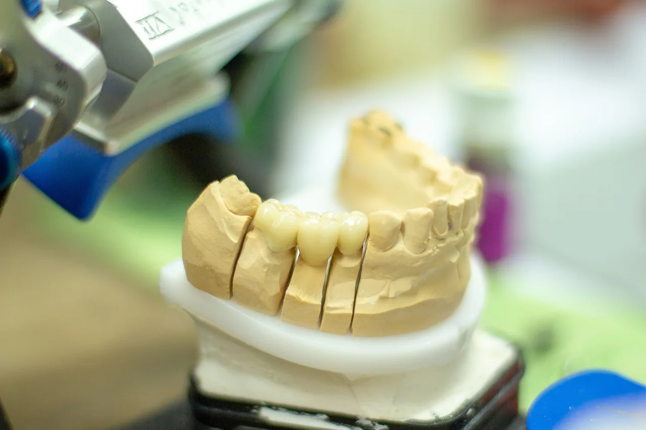 dentures, dentist, healthcare, dentistry, smile, ceramic, instruct, handwork, person, clinic, equipment, healthy, articulator, dentist, dentist, dentist, dentistry, dentistry, dentistry, dentistry, dentistry. What a serious dental reputation management checklist covers