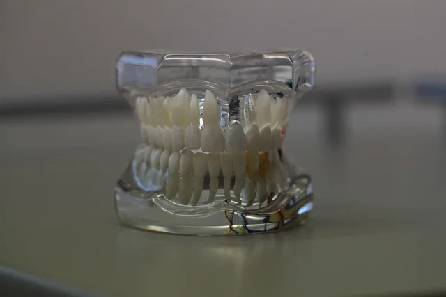 dentistry, dentals, teeth, model, jaw, tooth, healthcare, oral, care, denture, gray model, gray teeth, gray care, gray healthcare, dentistry, dentistry, jaw, tooth, tooth, tooth, tooth, tooth, oral, denture, denture. Dental social media benchmarks with the caveats attached