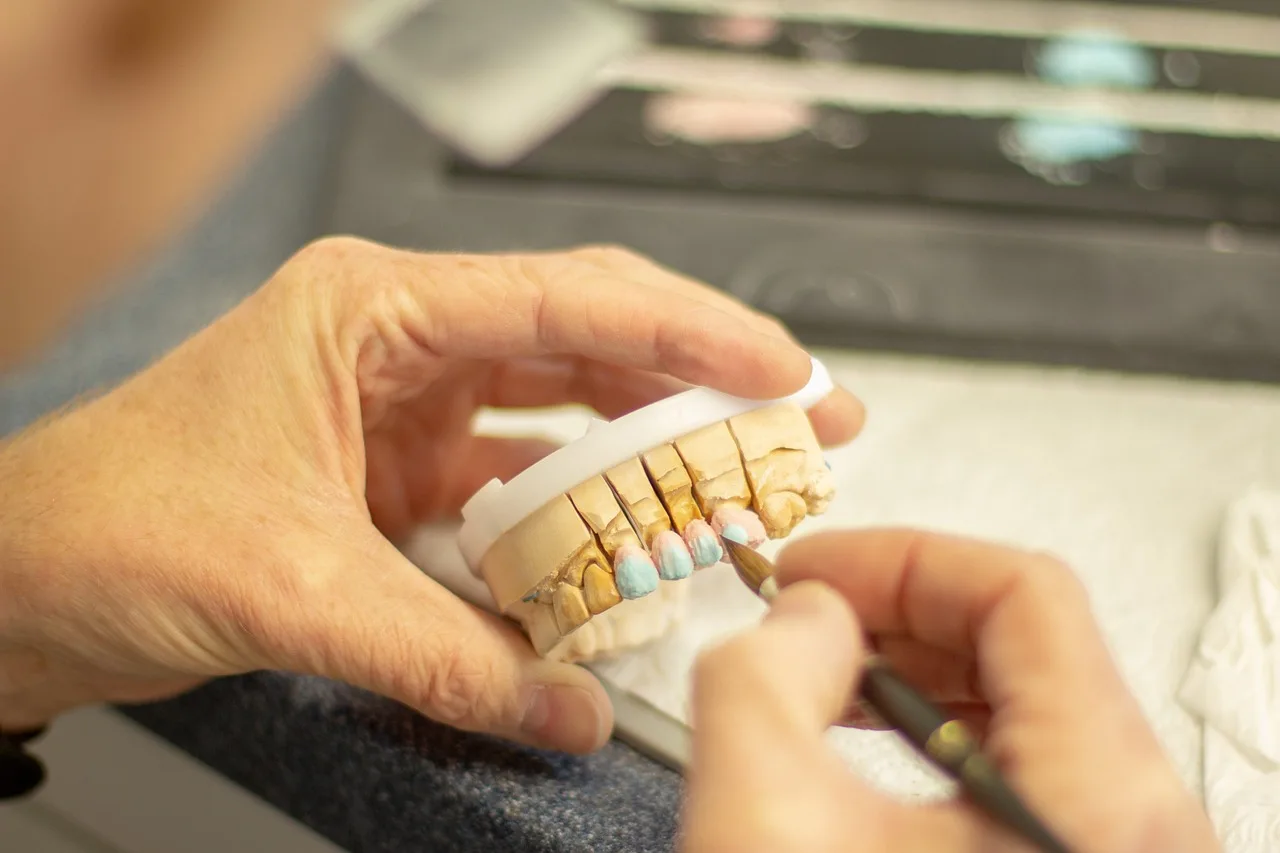 tooth replacement, dentist, healthcare, dentistry, smile, ceramic, applying, hand labor, person, clinic, equipment, brown smile, brown healthcare, dentist, dentist, dentistry, dentistry, dentistry, dentistry, dentistry. How to Improve Dental Advertising With a Repair Cycle