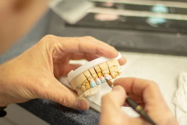 tooth replacement, dentist, healthcare, dentistry, smile, ceramic, applying, hand labor, person, clinic, equipment, brown smile, brown healthcare, dentist, dentist, dentistry, dentistry, dentistry, dentistry, dentistry. How to Improve Dental Advertising With a Repair Cycle